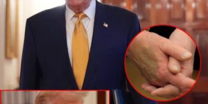 Trump diagnosed with ‘chronic venous insufficiency’ after swelling: White House