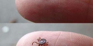 Here’s What to Do If You Spot a Lone Star Tick