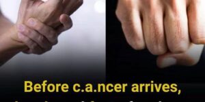 4 Early Warning Signs in Your Hands and Feet You Should Never Ignore