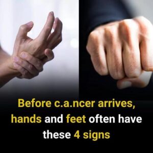 4 Early Warning Signs in Your Hands and Feet You Should Never Ignore