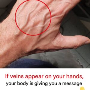 When should you be concerned about suddenly appearing veins?