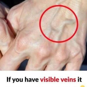 Why are your veins suddenly bulging and visible?