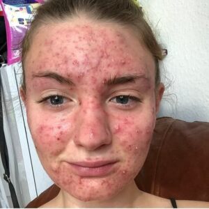 Her body was itching, I thought it was an allergy, they diagnosed ca… see more
