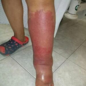 These are the consequences of sleeping with the.…See more
