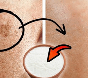 I Erased My Age Spots With a Cheap Kitchen Ingredient — Baking Soda Paste