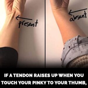 How to check if you’ve lost this tendon on your arm to evoluti
