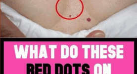 Should red spots on various part of your body worry you and what to do if you have them.