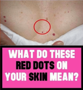 Should red spots on various part of your body worry you and what to do if you have them.