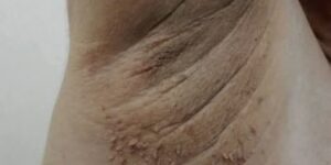 These are the first symptoms of cr … See more