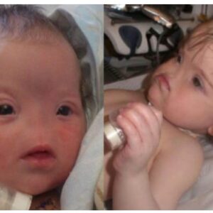 Consider this infant who was born without a nose…