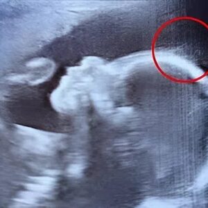 Doctors couldn’t believe what they saw during the ultrasound