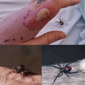 What to do if you get bit.ten by a black widow spider: A complete guide