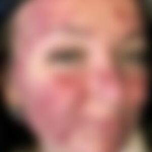 Her body was itchy, he thought it was an allergy!