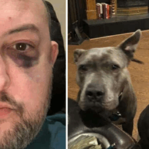 Man Adopts Unwanted Pit Bulls, Later They Repay Him By Saving New Dad’s Life